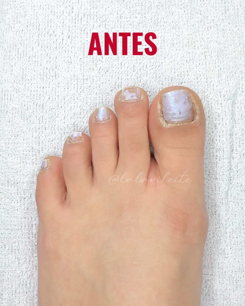 Pés Antes