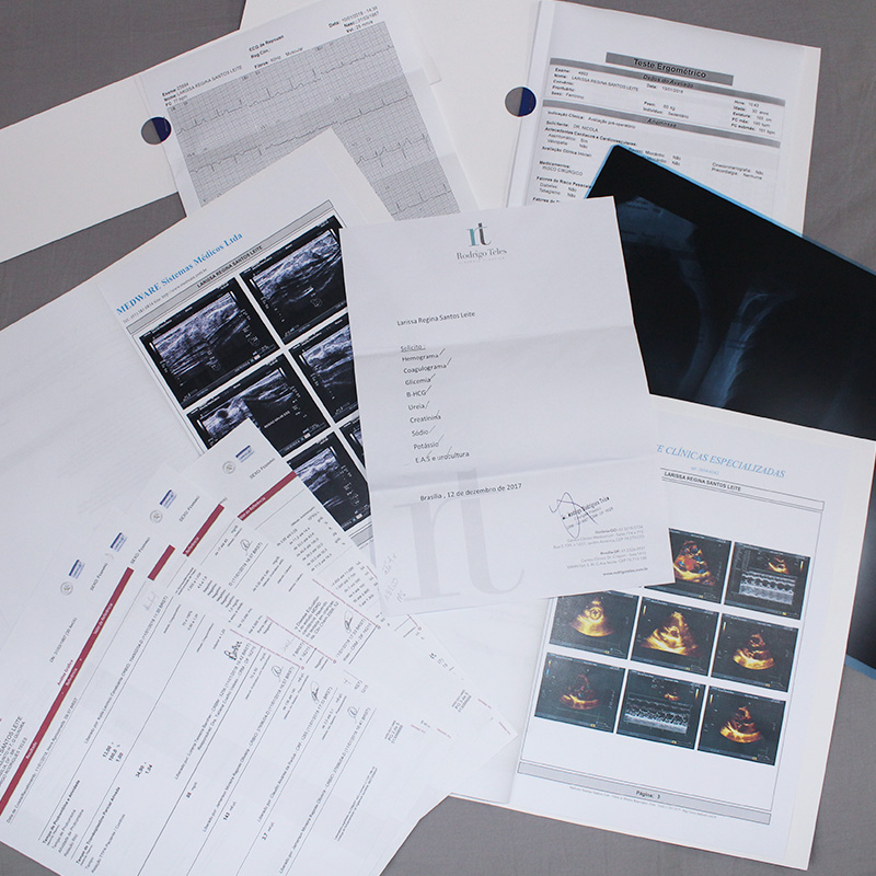 antes do silicone, o que preciso fazer antes do silicone, quanto custa cirurgia de silicone, quanto custa colocar prótese de silicone, diário do silicone, diário de silicone, mastopexia, mastopexia com prótese, silicone tenho que tirar pele, seios caídos, flacidez seios, silicone, prótese de silicone, como é antes do silicone, antes e depois do silicone, exames para colocar silicone, dr rodrigo teles, médico rodrigo teles, cirurgia plástica dr rodrigo teles, 