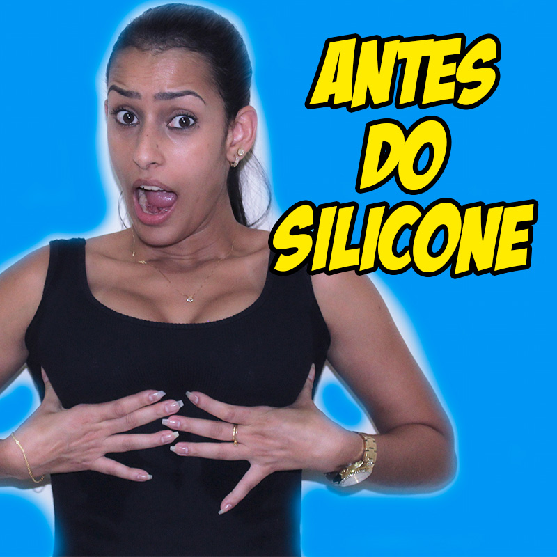 antes do silicone, o que preciso fazer antes do silicone, quanto custa cirurgia de silicone, quanto custa colocar prótese de silicone, diário do silicone, diário de silicone, mastopexia, mastopexia com prótese, silicone tenho que tirar pele, seios caídos, flacidez seios, silicone, prótese de silicone, como é antes do silicone, antes e depois do silicone, exames para colocar silicone, dr rodrigo teles, médico rodrigo teles, cirurgia plástica dr rodrigo teles,