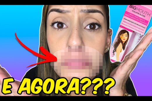 gloss labial, gloss que da volume nos lábios, preenchimento nos lábios, acido hialurônico, bocão em segundos, como ter os lábios grandes em segundos, boa preenchimento, gloss labial phallebeauty, big mouth, big mouth phallebeauty, alergia ao big mouth phallebeauty, gloss que aumenta os lábios deu alergia, alergia a produtos de maquiagem, reação alergica a produtos de maquiagem, unhas da lala, larissa leite, testando produtos, testando maquiagens, testando makes, testando gloss labial