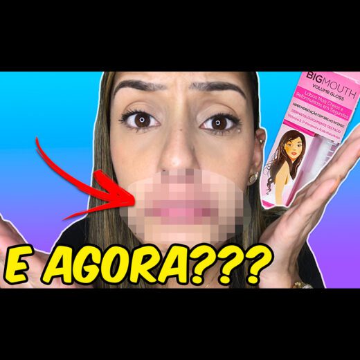 gloss labial, gloss que da volume nos lábios, preenchimento nos lábios, acido hialurônico, bocão em segundos, como ter os lábios grandes em segundos, boa preenchimento, gloss labial phallebeauty, big mouth, big mouth phallebeauty, alergia ao big mouth phallebeauty, gloss que aumenta os lábios deu alergia, alergia a produtos de maquiagem, reação alergica a produtos de maquiagem, unhas da lala, larissa leite, testando produtos, testando maquiagens, testando makes, testando gloss labial