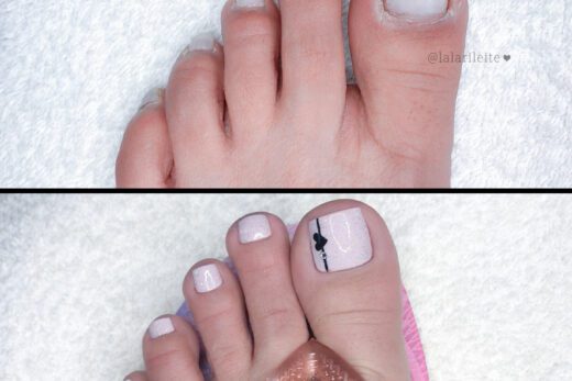 antes e depois unhas dos pés, como fazer as unhas dos pés, como fazer as unhas, como fazer unhas dos pés, como fazer unhas, como tirar cutícula os pés, decoração em casa, unhas dos pés decoradas, nail art nos pés, unhas decoradas, unhas dos pés, pedicure, unhas decoradas passo a passo, unhas decoradas fáceis, nail art, nail art pés, cola na villar, unhas decoradas para os pés, lindas unhas decoradas, fazer unhas, faça você mesmo, cutilagem passo a passo, como fazer as unhas em casa, cutícula unhas pés, cutilagem unhas dos pés, unhas da lala, larissa leite