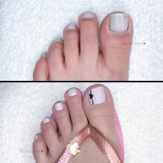 antes e depois unhas dos pés, como fazer as unhas dos pés, como fazer as unhas, como fazer unhas dos pés, como fazer unhas, como tirar cutícula os pés, decoração em casa, unhas dos pés decoradas, nail art nos pés, unhas decoradas, unhas dos pés, pedicure, unhas decoradas passo a passo, unhas decoradas fáceis, nail art, nail art pés, cola na villar, unhas decoradas para os pés, lindas unhas decoradas, fazer unhas, faça você mesmo, cutilagem passo a passo, como fazer as unhas em casa, cutícula unhas pés, cutilagem unhas dos pés, unhas da lala, larissa leite