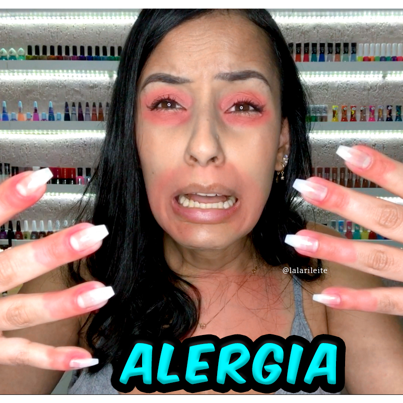 qual esmalte pode usar uma pessoa com alergia ,tenho alergia a esmalte posso usar, esmaltes hipoalergĂȘnicos, hipoalergĂȘnicos, esmalte hipoalergĂȘnico, esmaltes hipoalergenicos, esmalte free, esmaltes free, esmalte 3 free, esmalte 4 free, esmalte 5 free, esmalte 7 free, esmalte 9 free, alergia esmalte, marcas de esmaltes free, marcas de esmaltes hipoalergĂȘnicos, marcas de esmaltes nacionais hipoalergĂȘnicos, alergia, esmalte, esmalte para alergico, esmalte para quem tem alergia, formaldeido, tolueno, dbp, alergia coceira, unhas, nails, melhores marcas e linhas para quem tem alergia, esmalte vegano, esmalte Ă© hipoalergĂȘnico, esmalte hipoalergĂȘnico Ă© free, o que Ă© esmalte hipoalergĂȘnico, o que Ă© esmalte free, o que Ă© esmalte vegano, esmalte risquĂ© hipoalergĂȘnico, esmalte revlon 3 free, esmalte bella brazil 3 free, esmalte lorac a base d'ĂĄgua, o que Ă© esmalte a base d'ĂĄgua, esmalte mohda free, esmalte vult 5 free, esmalte vult hipoalergĂȘnico 5 free vegano, esmalte vult vegano, esmalte ludurana 3 free, esmalte hits 5 free, esmalte hits efeito gel 5 free, esmalte granado 5 free, esmalte allergic center hipoalergĂȘnico, esmalte eclat 7 free, esmalte colorama 5 free, esmalte beautycolor free, esmalte avon 5 free, esmalte avon color tren 5 free, esmalte avon pro color 5 free, esmalte avon gel finish 5 free, esmalte impala hipoalergĂȘnico, esmalte impala hipoalergĂȘnico vegano, esmalte impala hipoalergĂȘnico vegano, esmalte impala vegano, esmalte natura free, esmalte natura una 9 free, Larissa Leite, Larissa Leite unhas