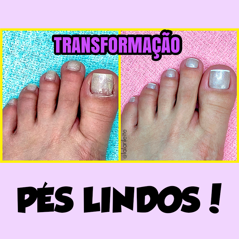 unhas dos pés, como arrumar as unhas dos pés, cutilagem unhas dos pés, como tirar cutícula das unhas dos pés, como fazer as unhas dos pés, como fazer francesinhas, francesinhas unhas dos pés, francesinhas, unhas francesinhas, unhas da lala, larissa leite, dicas de unhas, dicas unhas, dicas unhas dos pés