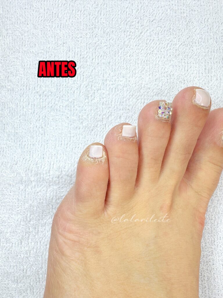 Mindinho Transformado Após Cutilagem