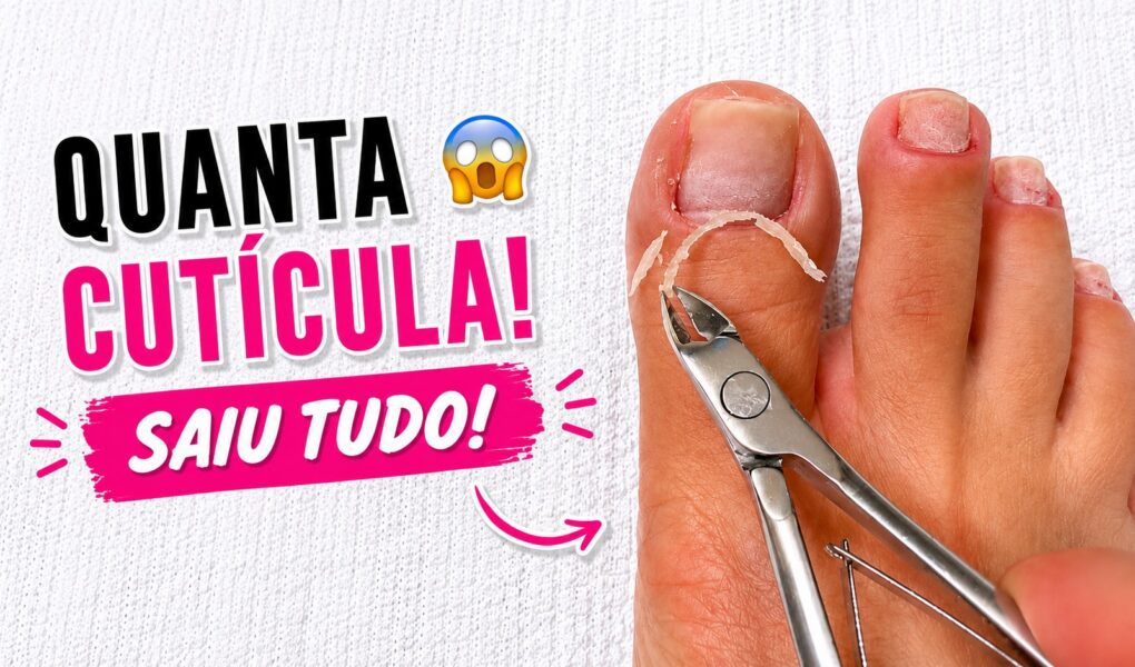 Quanta cutícula: como a remoção deixou o pezinho leve e caprichado