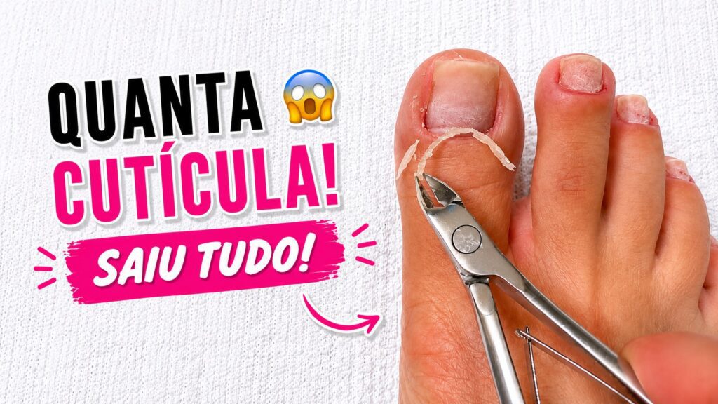 Quanta cutícula: como a remoção deixou o pezinho leve e caprichado
