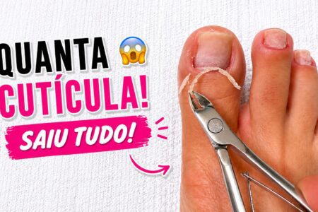 Quanta cutícula: como a remoção deixou o pezinho leve e caprichado