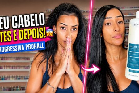 Antes e depois da progressiva na raiz com Pro Hall Select One